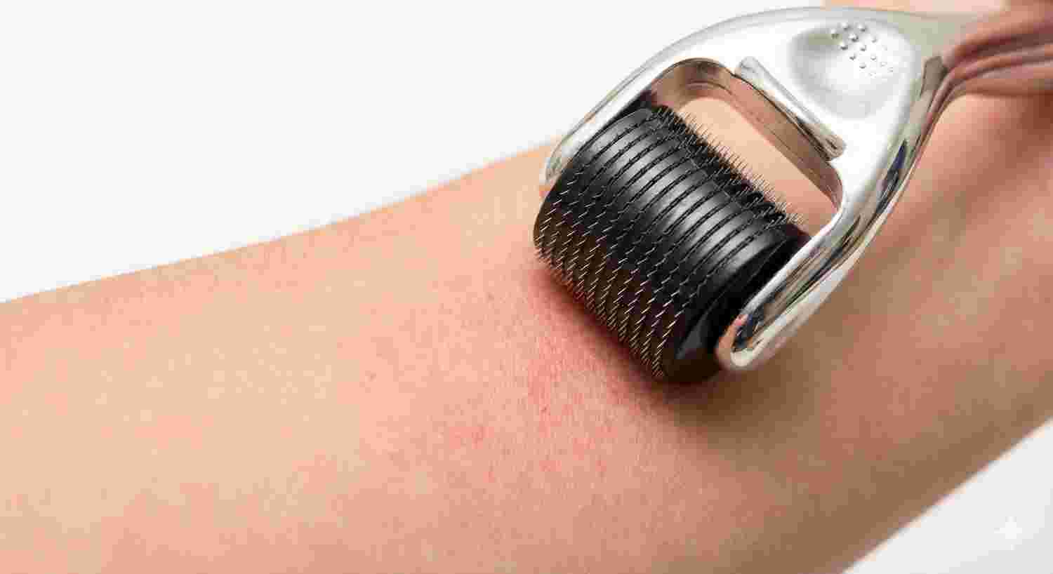 Derma Roller Kya Hai?